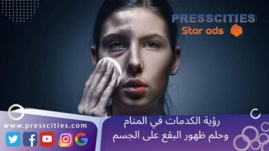 رؤية الكدمات في المنام وحلم ظهور البقع على الجسم