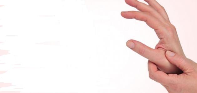 أضرار فرقعة الأصابع