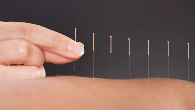 فوائد الإبر الصينية للأعصاب