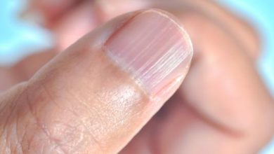 أعراض نقص الزنك